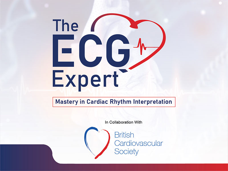 The ECG Expert